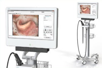 VIDEO ASSISTED NASENDOSCOPE